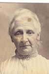 white hair